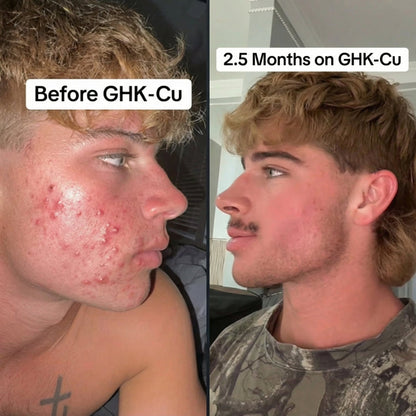 Haravi™ Copper Peptide Serum (GHK-Cu + HA)