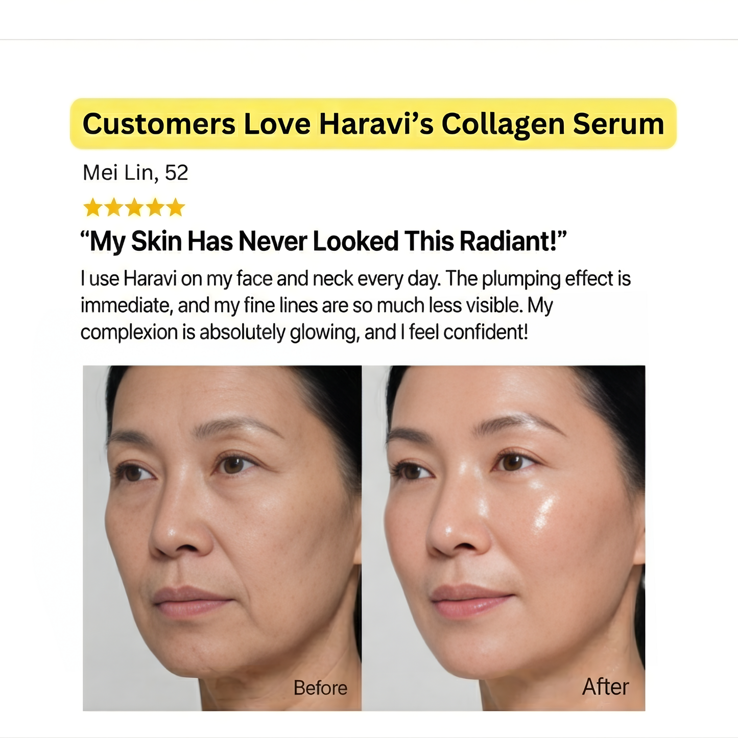 Haravi™ Korean Volufiline Infused Collagen Serum